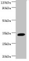 Western blot; All lanes: Transcription factor SOX-2 antibody at 2µg/ml + Mouse kidney tissue; Secondary; Goat polyclonal to rabbit IgG at 1/15000 dilution; Predicted band size: 34 kDa; Observed band size: 34 kDa;