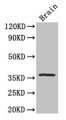 Western Blot; Positive WB detected in: Mouse brain tissue; All lanes: CREB1 antibody at 3.3µg/ml; Secondary; Goat polyclonal to rabbit IgG at 1/50000 dilution; Predicted band size: 37, 36, 26 kDa; Observed band size: 37 kDa