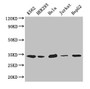 Western Blot; Positive WB detected in: K562 whole cell lysate, HEK293 whole cell lysate, Hela whole cell lysate, Jurkat whole cell lysate, HepG2 whole cell lysate; All lanes: CDK2 antibody at 2.6µg/ml; Secondary; Goat polyclonal to rabbit IgG at 1/50000 dilution; Predicted band size: 34, 31 kDa; Observed band size: 34 kDa