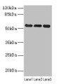 Western blot; All lanes: VIM antibody at 8µg/ml; Lane 1: Hela whole cell lysate; Lane 2: Jurkat whole cell lysate; Lane 3: A549 whole cell lysate; Secondary; Goat polyclonal to rabbit IgG at 1/10000 dilution; Predicted band size: 54 kDa; Observed band size: 54 kDa