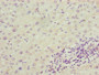 Immunohistochemistry of paraffin-embedded human liver cancer using CAC07068 at dilution of 1:100