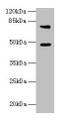 Western blot; All lanes: Casp12 antibody at 6µg/ml + LO2 whole cell lysate; Secondary; Goat polyclonal to rabbit IgG at 1/10000 dilution; Predicted band size: 48 kDa; Observed band size: 48, 75 kDa