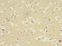 Immunohistochemistry of paraffin-embedded human brain tissue using CAC07078 at dilution of 1:100