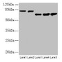 Western blot; All lanes: APP antibody at 2.4µg/ml; Lane 1: Mouse brain tissue; Lane 2: 293 whole cell lysate; Lane 3: A549 whole cell lysate; Lane 4: U251 whole cell lysate; Lane 5: SH-SY5Y whole cell lysate; Secondary; Goat polyclonal to rabbit IgG at 1/15000 dilution; Predicted band size: 87, 35, 77, 79, 81, 83, 85, 86, 73 kDa; Observed band size: 81, 73 kDa