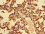 Immunohistochemistry of paraffin-embedded human lung tissue using CAC07124 at dilution of 1:100