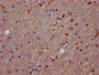 IHC image diluted at 1:1200 and staining in paraffin-embedded human brain tissue performed on a Leica BondTM system. After dewaxing and hydration, antigen retrieval was mediated by high pressure in a citrate buffer (pH 6.0). Section was blocked with 10% normal goat serum 30min at RT. Then primary antibody (1% BSA) was incubated at 4°C overnight. The primary is detected by a biotinylated secondary antibody and visualized using an HRP conjugated SP system.