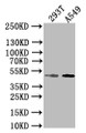 Western blot; All lanes: E2F2 antibody at 2µg/ml + 293T whole cell lysate; Secondary; Goat polyclonal to rabbit IgG at 1/10000 dilution; Predicted band size: 48 kDa; Observed band size: 48 kDa