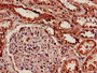 IHC image diluted at 1:600 and staining in paraffin-embedded human kidney tissue performed on a Leica BondTM system. After dewaxing and hydration, antigen retrieval was mediated by high pressure in a citrate buffer (pH 6.0). Section was blocked with 10% normal goat serum 30min at RT. Then primary antibody (1% BSA) was incubated at 4°C overnight. The primary is detected by a biotinylated secondary antibody and visualized using an HRP conjugated SP system.