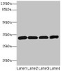 Western blot; All lanes: Ms4a1 antibody at 4µg/ml; Lane 1: Hela whole cell lysate; Lane 2: Jurkat whole cell lysate; Lane 3: 293T whole cell lysate; Lane 4: HL60 whole cell lysate; Secondary; Goat polyclonal to rabbit IgG at 1/10000 dilution; Predicted band size: 32 kDa; Observed band size: 32 kDa