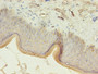 Immunohistochemistry of paraffin-embedded human skin tissue using CAC07209 at dilution of 1:100