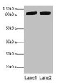 Western blot; All lanes: POSTN antibody at 2µg/ml; Lane 1: Mouse liver tissue; Lane 2: Hela whole cell lysate; Secondary; Goat polyclonal to rabbit IgG at 1/10000 dilution; Predicted band size: 94, 88, 84, 91, 81 kDa; Observed band size: 94 kDa