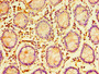 Immunohistochemistry of paraffin-embedded human colon tissue using CAC07225 at dilution of 1:100