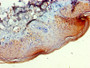 Immunohistochemistry of paraffin-embedded human skin tissue using CAC07228 at dilution of 1:100
