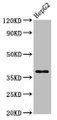 Western Blot; ,Positive WB detected in: HepG2 whole cell lysate; ,All lanes: HNRNPA1 antibody at 3.9µg/ml; ,Secondary; ,Goat polyclonal to rabbit IgG at 1/50000 dilution; ,Predicted band size: 39, 35, 30 kDa; ,Observed band size: 39 kDa