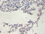 Immunohistochemistry of paraffin-embedded human lung tissue using CAC07250 at dilution of 1:100