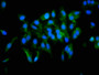 Immunofluorescence staining of Hela cells with CAC07251 at 1:133, counter-stained with DAPI. The cells were fixed in 4% formaldehyde, permeabilized using 0.2% Triton X-100 and blocked in 10% normal Goat Serum. The cells were then incubated with the antibody overnight at 4°C. The secondary antibody was Alexa Fluor 488-congugated AffiniPure Goat Anti-Rabbit IgG(H+L).