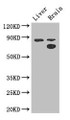 Western Blot; Positive WB detected in: Mouse liver tissue, Mouse brain tissue; All lanes: SMURF1 antibody at 3.4µg/ml; Secondary; Goat polyclonal to rabbit IgG at 1/50000 dilution; Predicted band size: 87, 84 kDa; Observed band size: 87, 70 kDa;