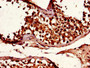 Immunohistochemistry of paraffin-embedded human testis tissue using CAC07256 at dilution of 1:100