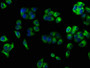 Immunofluorescence staining of PC-3 cells with CAC07258 at 1:100, counter-stained with DAPI. The cells were fixed in 4% formaldehyde, permeabilized using 0.2% Triton X-100 and blocked in 10% normal Goat Serum. The cells were then incubated with the antibody overnight at 4°C. The secondary antibody was Alexa Fluor 488-congugated AffiniPure Goat Anti-Rabbit IgG(H+L).