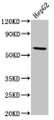 Western Blot; ,Positive WB detected in: HepG2 whole cell lysate; ,All lanes: RORC antibody at 5.2µg/ml; ,Secondary; ,Goat polyclonal to rabbit IgG at 1/50000 dilution; ,Predicted band size: 59, 56 kDa; ,Observed band size: 59 kDa