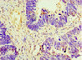 Immunohistochemistry of paraffin-embedded human ovarian cancer using CAC07283 at dilution of 1:100