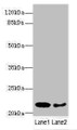 Western blot; All lanes: PRDX2 antibody at 9µg/ml; Lane 1: Mouse liver tissue; Lane 2: Mouse spleen tissue; Secondary; Goat polyclonal to rabbit IgG at 1/10000 dilution; Predicted band size: 22, 16 kDa; Observed band size: 22 kDa;