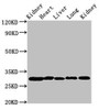 Western Blot; Positive WB detected in: Rat kidney tissue, Rat heart tissue, Rat liver tissue, Mouse lung tissue, Mouse kidney tissue; All lanes: CA2 antibody at 2µg/ml; Secondary; Goat polyclonal to rabbit IgG at 1/50000 dilution; Predicted band size: 30 kDa; Observed band size: 30 kDa