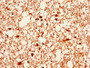 IHC image diluted at 1:400 and staining in paraffin-embedded human brain tissue performed on a Leica BondTM system. After dewaxing and hydration, antigen retrieval was mediated by high pressure in a citrate buffer (pH 6.0). Section was blocked with 10% normal goat serum 30min at RT. Then primary antibody (1% BSA) was incubated at 4°C overnight. The primary is detected by a biotinylated secondary antibody and visualized using an HRP conjugated SP system.