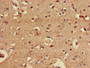 Immunohistochemistry of paraffin-embedded human brain tissue using CAC07297 at dilution of 1:100