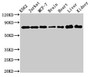 Western Blot; Positive WB detected in: K562 whole cell lysate, Jurkat whole cell lysate, MCF-7 whole cell lysate, Rat brain tissue, Rat heart tissue, Mouse liver tissue, Mouse kidney tissue; All lanes: DDX3X antibody at 3µg/ml; Secondary; Goat polyclonal to rabbit IgG at 1/50000 dilution; Predicted band size: 74, 72 kDa; Observed band size: 74 kDa