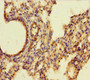 Immunohistochemistry of paraffin-embedded human lung tissue using CAC07299 at dilution of 1:100