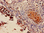 Immunohistochemistry of paraffin-embedded human lung tissue using CAC07304 at dilution of 1:100