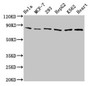 Western Blot; Positive WB detected in: Hela whole cell lysate, MCF-7 whole cell lysate, 293 whole cell lysate, HepG2 whole cell lysate, K562 whole cell lysate, Mouse heart tissue; All lanes: TRAP1 antibody at 2µg/ml; Secondary; Goat polyclonal to rabbit IgG at 1/50000 dilution; Predicted band size: 81, 75 kDa; Observed band size: 81 kDa