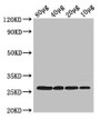 Western Blot; Positive WB detected in: Rosseta bacteria lysate at 80µg, 40µg, 20µg, 10µg; All lanes: rpsB antibody at 2.5µg/ml; Secondary; Goat polyclonal to rabbit IgG at 1/50000 dilution; predicted band size: 27 kDa; observed band size: 27 kDa;