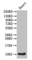 Western Blot; ,Positive WB detected in: Mouse heart tissue; ,All lanes: IAPP antibody at 1µg/ml; ,Secondary; ,Goat polyclonal to rabbit IgG at 1/50000 dilution; ,Predicted band size: 10 kDa; ,Observed band size: 10 kDa