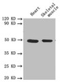 Western blot; All lanes: PLAU antibody at 1.8µg/ml; Lane 1: Mouse heart tissue; Lane 2: Mouse skeletal muscle tissue; Secondary; Goat polyclonal to rabbit IgG at 1/10000 dilution; Predicted band size: 49, 47 kDa; Observed band size: 49 kDa