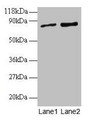 Western blot; All lanes: RAB1A antibody at 2µg/ml; Lane 1: EC109 whole cell lysate; Lane 2: 293T whole cell lysate; Secondary; Goat polyclonal to rabbit IgG at 1/15000 dilution; Predicted band size: 23, 16, 14 kDa; Observed band size: 80 kDa