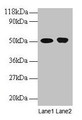 Western blot; All lanes: ODC1 antibody at 2µg/ml; Lane 1: EC109 whole cell lysate; Lane 2: 293T whole cell lysate; Secondary; Goat polyclonal to rabbit IgG at 1/15000 dilution; Predicted band size: 52 kDa; Observed band size: 52 kDa