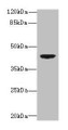 Western blot; All lanes: DAPK2 antibody at 6µg/ml + Mouse brain tissue; Secondary; Goat polyclonal to rabbit IgG at 1/10000 dilution; Predicted band size: 43, 56 kDa; Observed band size: 43 kDa