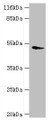 Western blot; All lanes: DRD5 antibody at 2µg/ml + Mouse brain tissue; Secondary; Goat polyclonal to rabbit IgG at 1/10000 dilution; Predicted band size: 53 kDa; Observed band size: 53 kDa