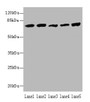 Western blot; All lanes: Hspa1b antibody at 5µg/ml; Lane 1: A431 whole cell lysate; Lane 2: A549 whole cell lysate; Lane 3: Jurkat whole cell lysate; Lane 4: MCF-7 whole cell lysate; Lane 5: K562 whole cell lysate; Secondary; Goat polyclonal to rabbit IgG at 1/10000 dilution; Predicted band size: 71 kDa; Observed band size: 71 kDa