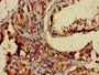 Immunohistochemistry of paraffin-embedded human testis tissue using CAC07362 at dilution of 1:100