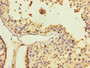 Immunohistochemistry of paraffin-embedded human testis tissue using CAC07377 at dilution of 1:100