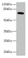 Western blot; All lanes: ARPC3 antibody at 2µg/ml + 293T whole cell lysate; Secondary; Goat polyclonal to rabbit IgG at 1/15000 dilution; Predicted band size: 21 kDa; Observed band size: 75 kDa