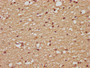 IHC image of CAC07382 diluted at 1:200 and staining in paraffin-embedded human brain tissue performed on a Leica BondTM system. After dewaxing and hydration, antigen retrieval was mediated by high pressure in a citrate buffer (pH 6.0). Section was blocked with 10% normal goat serum 30min at RT. Then primary antibody (1% BSA) was incubated at 4°C overnight. The primary is detected by a biotinylated secondary antibody and visualized using an HRP conjugated SP system.