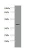 Western blot; All lanes: Creatine kinase M-type antibody at 2µg/ml + 293T whole cell lysate; Secondary; Goat polyclonal to rabbit IgG at 1/10000 dilution; Predicted band size: 44 kDa; Observed band size: 44 kDa