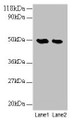 Western blot; All lanes: LCAT antibody at 2µg/ml; Lane 1: EC109 whole cell lysate; Lane 2: 293T whole cell lysate; Secondary; Goat polyclonal to rabbit IgG at 1/10000 dilution; Predicted band size: 50 kDa; Observed band size: 50 kDa