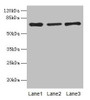 Western blot; All lanes: Afp antibody at 10µg/ml; Lane 1: HepG2 whole cell lysate; Lane 2: Rat liver tissue; Lane 3: 293T whole cell lysate; Secondary; Goat polyclonal to rabbit IgG at 1/10000 dilution; Predicted band size: 68 kDa; Observed band size: 68 kDa