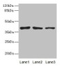 Western blot; All lanes: ATP6AP2 antibody at 10µg/ml; Lane 1: Mouse eye tissue; Lane 2: COLO205 whole cell lysate; Lane 3: Hela whole cell lysate; Secondary; Goat polyclonal to rabbit IgG at 1/10000 dilution; Predicted band size: 40, 36 kDa; Observed band size: 40 kDa