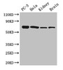 Western Blot; Positive WB detected in: PC-3 whole cell lysate, Hela whole cell lysate, Mouse kidney tissue, Mouse brain tissue; All lanes: GPI antibody at 2.7µg/ml; Secondary; Goat polyclonal to rabbit IgG at 1/50000 dilution; Predicted band size: 64, 65 kDa; Observed band size: 64 kDa